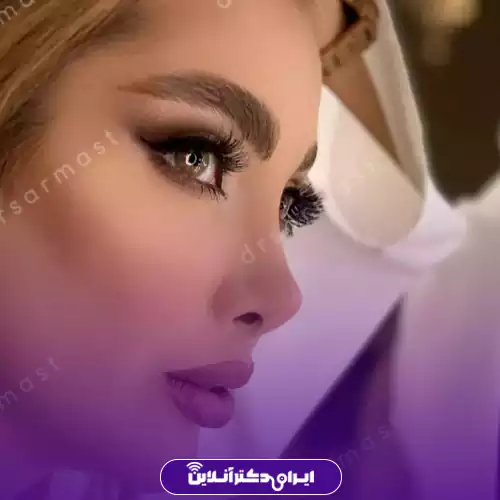 بهترین جراح بینی فانتزی در تهران (لیست 10 پزشک برتر + نمونه کار) 154 نمونه کار عمل فانتزی بینی دکتر هادی سرمست 3