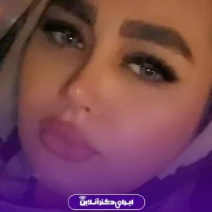 نمونه کار عمل بینی دکتر شاهین فتح سامی 1