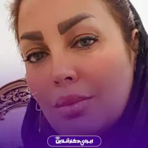 نمونه کار عمل بینی دکتر شاهین فتح سامی 2