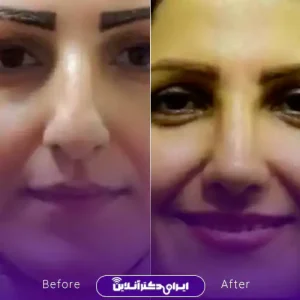 نمونه کار دکتر شاهین فتح سامی - 2