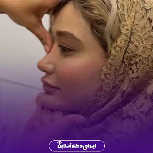 بهترین جراح بینی فانتزی در تهران (لیست 10 پزشک برتر + نمونه کار) 145 نمونه کار عمل بینی فانتزی دکتر سولماز قربانی 4
