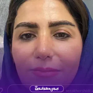 نمونه کار دکتر رضا خورشیدی خیاوی - 10