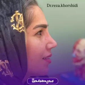 نمونه کار عمل بینی دکتر رضا خورشیدی خیاوی 4