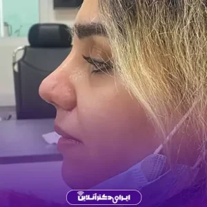 نمونه کار عمل بینی دکتر رضا خورشیدی خیاوی 5