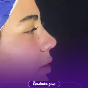 نمونه کار عمل بینی دکتر رضا خورشیدی خیاوی 7
