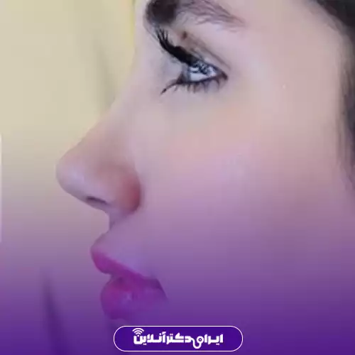 بهترین جراح بینی فانتزی در تهران (لیست 10 پزشک برتر + نمونه کار) 133 نمونه کار جراحی بینی فانتزی دکتر حمیدرضا راستی 2