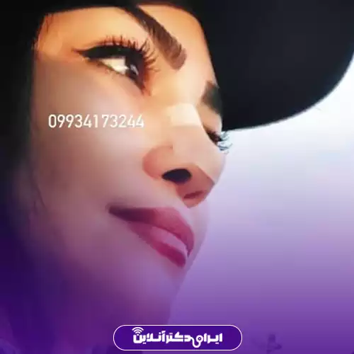 بهترین جراح بینی استخوانی در تهران + لیست 8 پزشک متخصص 122 نمونه کار عمل بینی استخوانی دکتر آرزو خوانسارینیا 1
