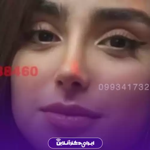 بهترین جراح بینی استخوانی در تهران + لیست 8 پزشک متخصص 123 نمونه کار عمل بینی استخوانی دکتر آرزو خوانسارینیا 2
