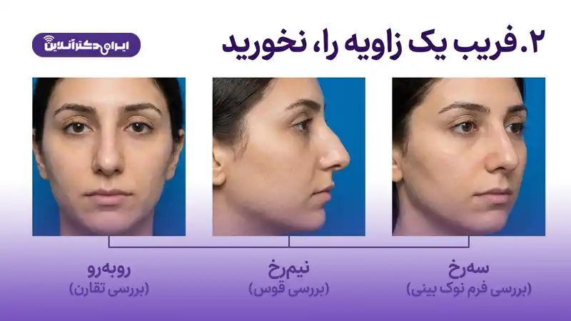 عکس‌های روبه‌رو و نیم‌رخ را مقایسه کنید