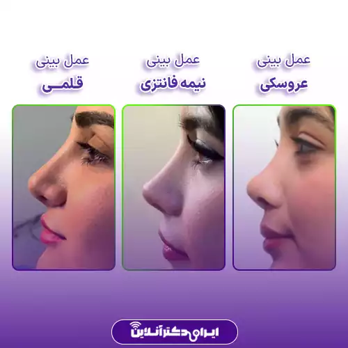 مقایسه بینی قلمی با بینی عروسکی و فانتزی
