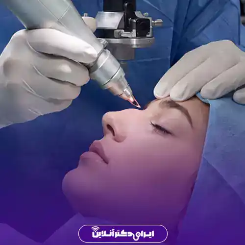رفع قوز بینی با لیزر؛ لیزر قوز بینی واقعیت دارد؟ 2 لیزر قوز بینی چیست و رفع قوز بینی با لیزر چگونه است؟