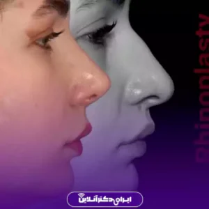 نمونه کار عمل بینی دکتر علیرضا مجلسی 5