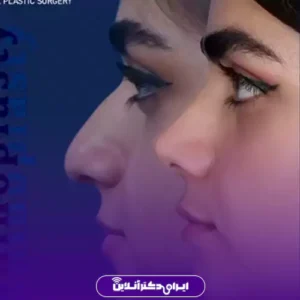 نمونه کار عمل بینی دکتر علیرضا مجلسی 7