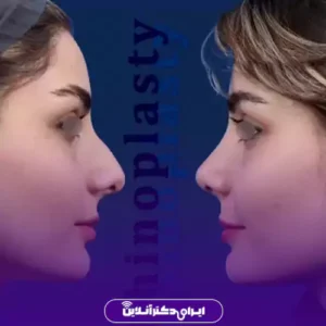 نمونه کار عمل بینی دکتر علیرضا مجلسی 8