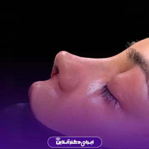 نمونه کار عمل بینی دکتر امیرحسین اسدالله‌پور 2