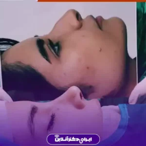نمونه کار عمل بینی دکتر آرش کرمی 2