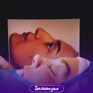نمونه کار عمل بینی دکتر آرش کرمی 3