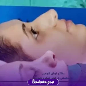 نمونه کار عمل بینی دکتر آرش کرمی 5