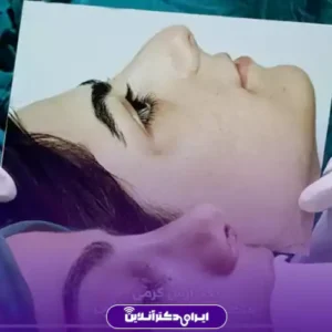 نمونه کار عمل بینی دکتر آرش کرمی 6