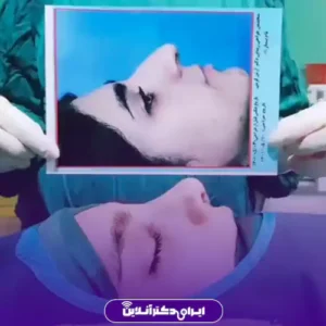 نمونه کار عمل بینی دکتر آرش کرمی 7