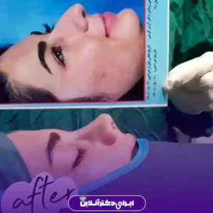 نمونه کار عمل بینی دکتر آرش کرمی 9