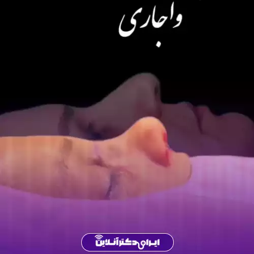 نمونه کار قبل و بعد عمل بینی دکتر حسینی واجاری 4