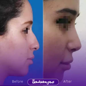 نمونه کار عمل بینی دکتر مهدی قائدی 1
