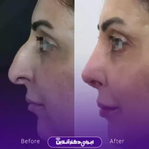 نمونه کار عمل بینی دکتر مهدی قائدی 10
