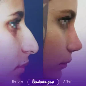 نمونه کار عمل بینی دکتر مهدی قائدی 2