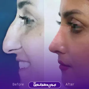 نمونه کار عمل بینی دکتر مهدی قائدی 3