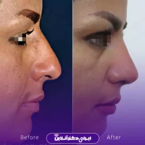 نمونه کار عمل بینی دکتر مهدی قائدی 4