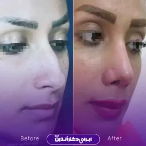 نمونه کار عمل بینی دکتر مهدی قائدی 6