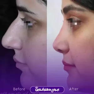 نمونه کار عمل بینی دکتر مهدی قائدی 7