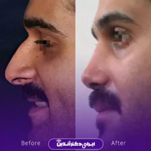 نمونه کار عمل بینی دکتر مهدی قائدی 8
