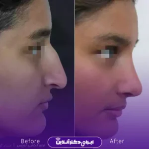 نمونه کار عمل بینی دکتر مهدی قائدی 9