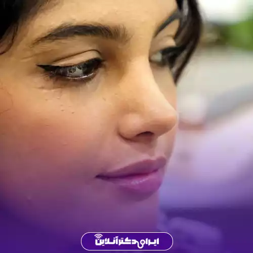 نمونه کار عمل بینی دکتر مهدی شهاب الدینی 1