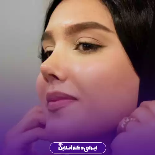 نمونه کار عمل بینی دکتر مهدی شهاب الدینی 3