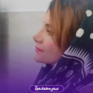 نمونه کار عمل بینی دکتر نفیسه صادق زاده 1