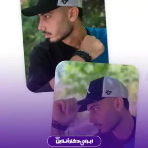 نمونه کار عمل بینی دکتر نفیسه صادق زاده 10