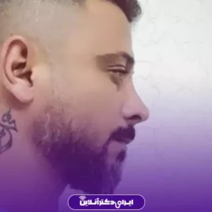 نمونه کار عمل بینی دکتر نفیسه صادق زاده 3