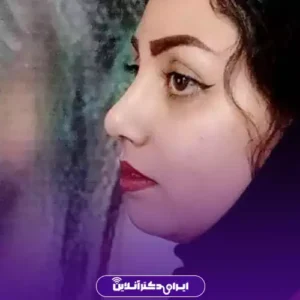 نمونه کار عمل بینی دکتر نفیسه صادق زاده 5