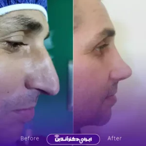 نمونه کار عمل بینی دکتر نفیسه صادق زاده 7