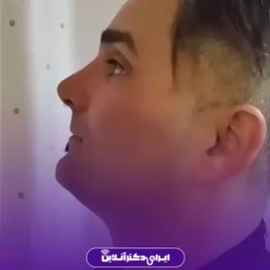نمونه کار عمل بینی دکتر نفیسه صادق زاده 8