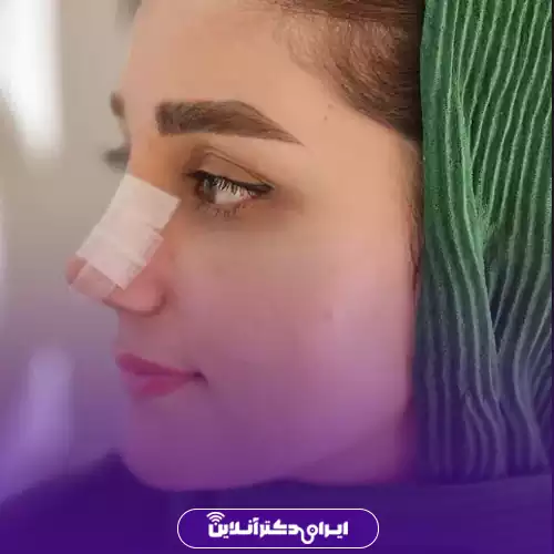 نمونه کار عمل بینی دکتر نسرین سیار 3