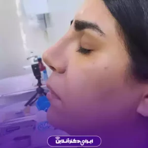 نمونه کار عمل بینی دکتر سهیلا مهرآور 3