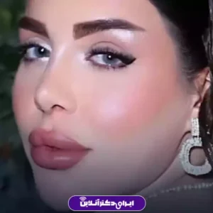 نمونه کار عمل بینی دکتر محمد لاجوردی 1