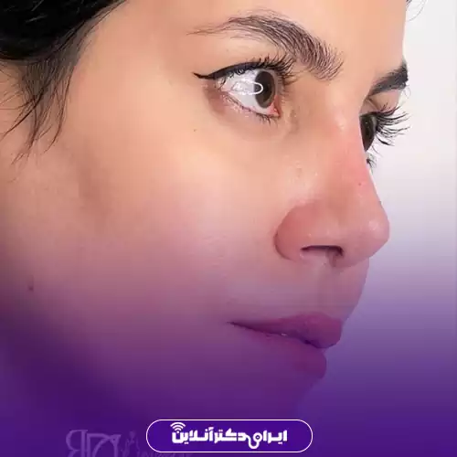 بهترین جراح بینی در تهران + لیست 34 مورد از بهترین جراحان 101 نمونه کار عمل بینی دکتر محمد لاجوردی 4