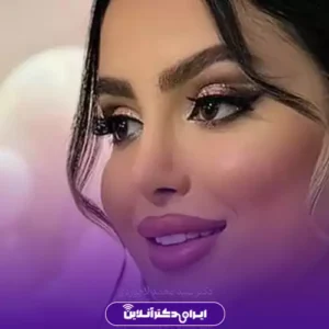 نمونه کار عمل بینی دکتر محمد لاجوردی 7