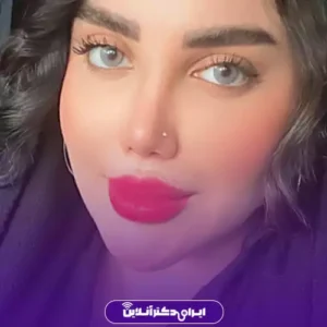 نمونه کار عمل بینی دکتر محمد لاجوردی 8