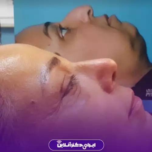 نمونه کار عمل بینی گوشتی دکتر نوشین فتوحی در رشت 1
